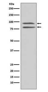 Anti-Phospho-MSK1 (S376) RPS6KA5 Monoclonal Antibody Boster Bio