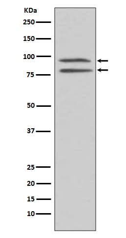 Anti-Phospho-MSK1 (S376) RPS6KA5 Monoclonal Antibody Boster Bio