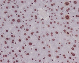 Anti-Phospho-Histone H3 (S10) HIST1H3A Rabbit Monoclonal Antibody Boster Bio