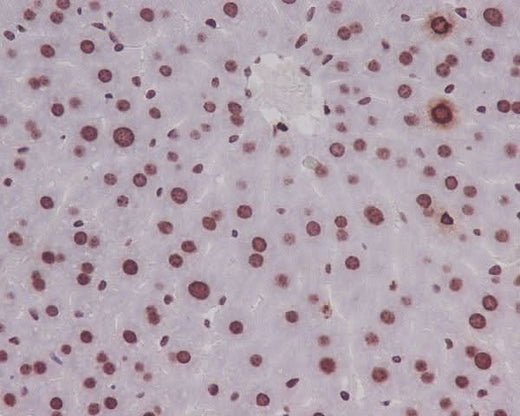 Anti-Phospho-Histone H3 (S10) HIST1H3A Rabbit Monoclonal Antibody Boster Bio