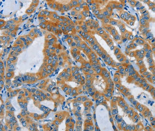 Anti-Human/Mouse/Rat DDAH1 Antibody - ABMIUM