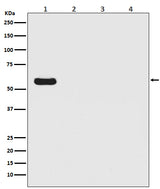 Anti-Firefly Luciferase Rabbit Monoclonal Antibody Boster Bio