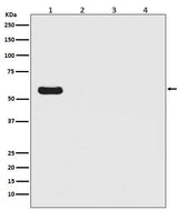 Anti-Firefly Luciferase Rabbit Monoclonal Antibody Boster Bio