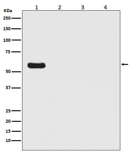 Anti-Firefly Luciferase Rabbit Monoclonal Antibody Boster Bio