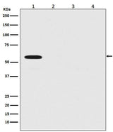 Anti-Firefly Luciferase Rabbit Monoclonal Antibody Boster Bio