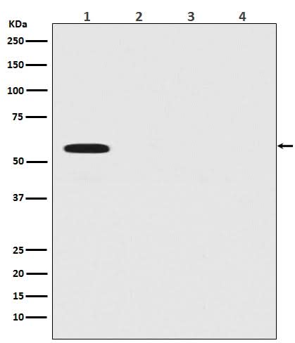 Anti-Firefly Luciferase Rabbit Monoclonal Antibody Boster Bio
