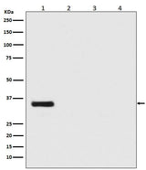 Anti-Renilla Luciferase Rabbit Monoclonal Antibody Boster Bio