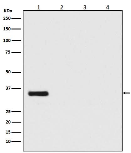 Anti-Renilla Luciferase Rabbit Monoclonal Antibody Boster Bio
