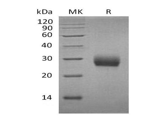 Recombinant Mouse RANK/TNFRSF11A Protein (His Tag) - ABMIUM