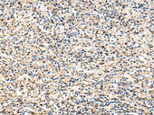 Anti-Human/Mouse/Rat VCAM1 Antibody