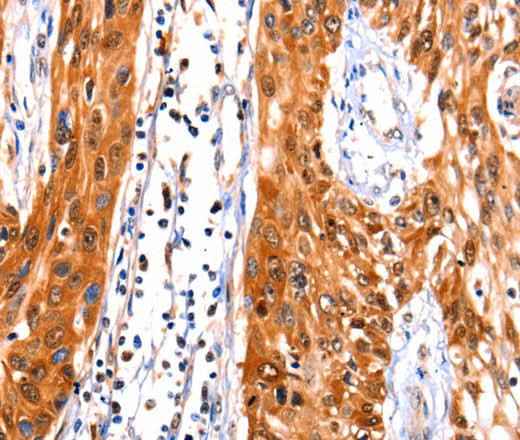 Anti-Human FBLN1 Antibody