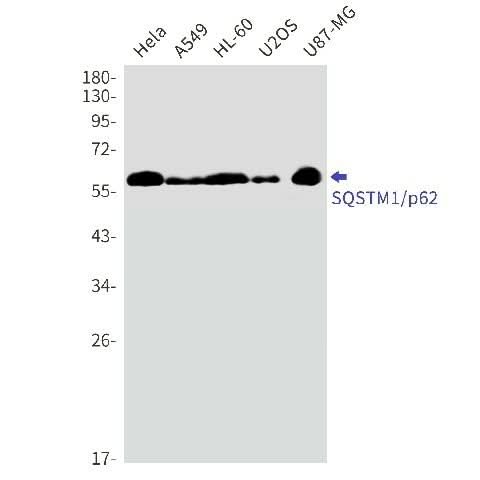 Western blot detection of SQSTM1/p62 in A549,HL-60,U2OS cell lysates using SQSTM1/p62 Rabbit mAb(1:1000 diluted).Predicted band size:48kDa.Observed band size:62kDa.