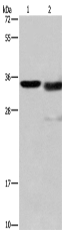 Anti-Human/Mouse CTSL Antibody - ABMIUM