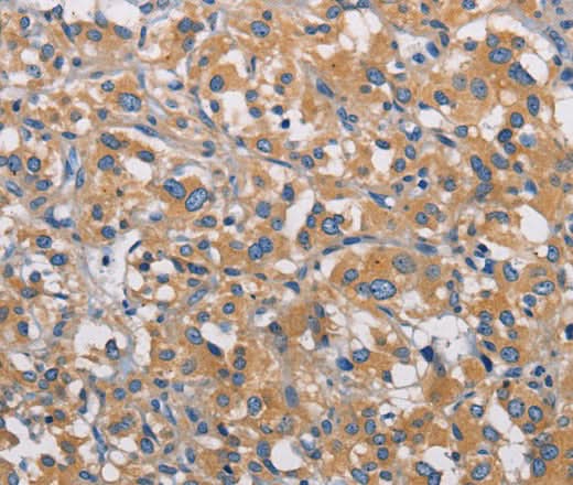 Anti-Human/Mouse PIKFYVE Antibody - ABMIUM