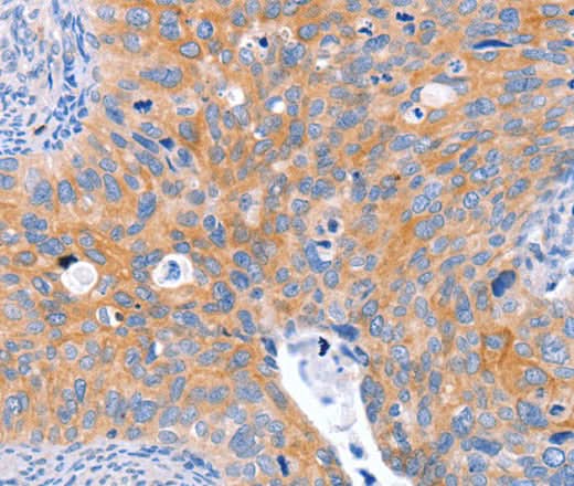 Anti-Human ABO Antibody - ABMIUM