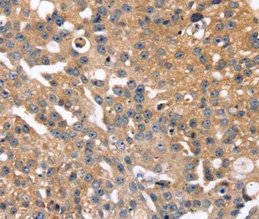 Anti-Human SLC2A2 Antibody