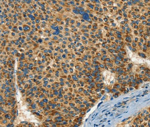 Anti-Human IFT74 Antibody - ABMIUM