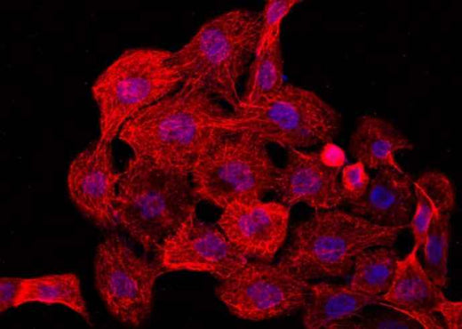 Anti-Human CCR2 Antibody - ABMIUM