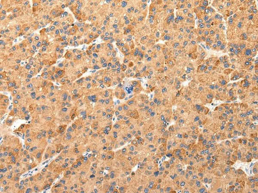 Anti-Human AQP7 Antibody - ABMIUM