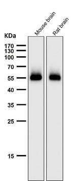 Anti-p53 (acetyl K370) TP53 Rabbit Monoclonal Antibody Boster Bio
