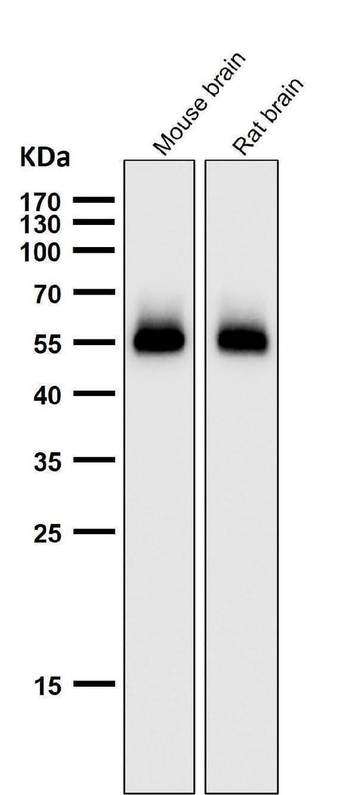 Anti-p53 (acetyl K370) TP53 Rabbit Monoclonal Antibody Boster Bio