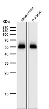 Anti-p53 (acetyl K370) TP53 Rabbit Monoclonal Antibody Boster Bio
