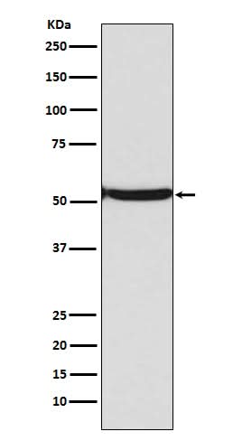 Anti-p53 (acetyl K382) TP53 Rabbit Monoclonal Antibody Boster Bio