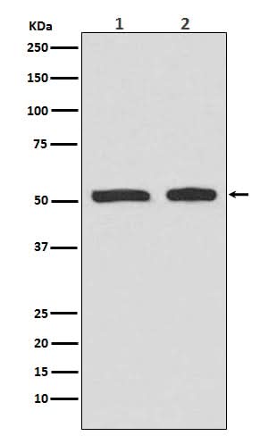 Anti-Phospho-p53 (S9) TP53 Rabbit Monoclonal Antibody Boster Bio