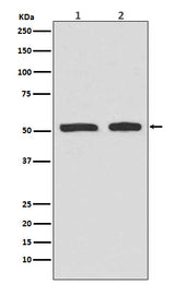 Anti-Phospho-p53 (S9) TP53 Rabbit Monoclonal Antibody Boster Bio