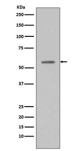Anti-Phospho-p53 (S33) TP53 Rabbit Monoclonal Antibody Boster Bio