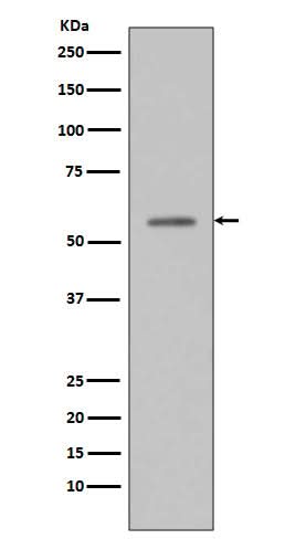 Anti-Phospho-p53 (S33) TP53 Rabbit Monoclonal Antibody Boster Bio