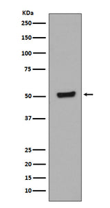 Anti-Phospho-p53 (T55) TP53 Rabbit Monoclonal Antibody Boster Bio