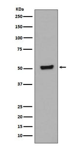 Anti-Phospho-p53 (T55) TP53 Rabbit Monoclonal Antibody Boster Bio