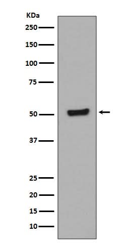 Anti-Phospho-p53 (T55) TP53 Rabbit Monoclonal Antibody Boster Bio