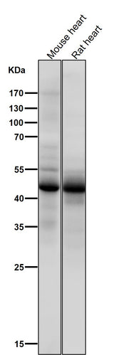 Anti-Phospho-p53 (S376) TP53 Rabbit Monoclonal Antibody Boster Bio