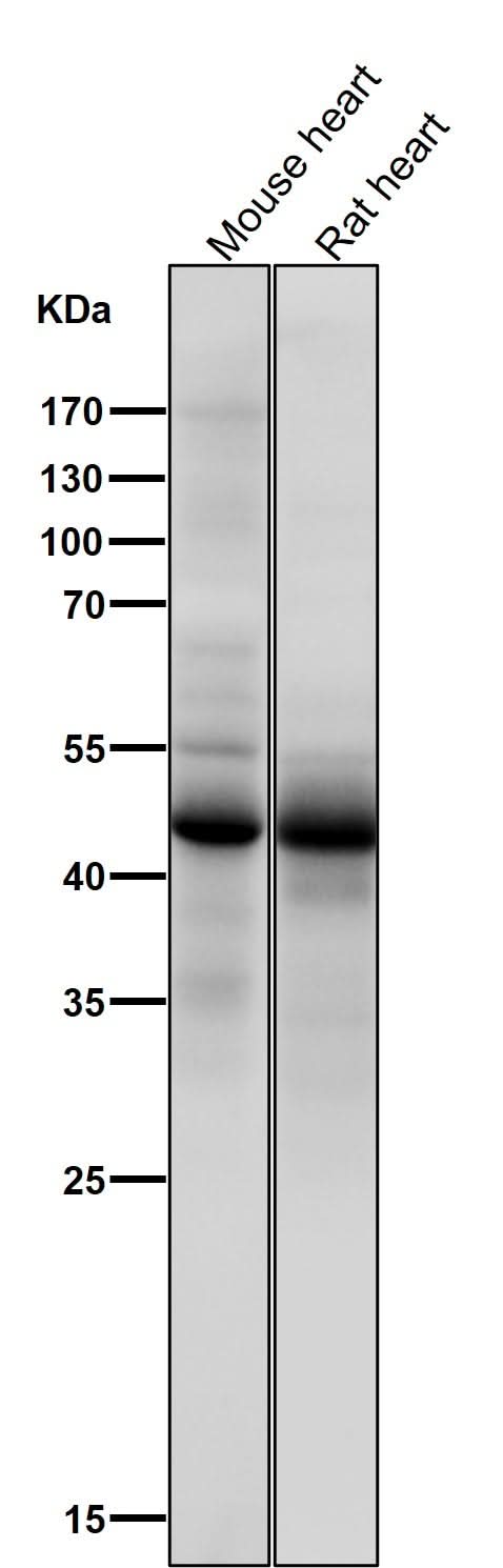 Anti-Phospho-p53 (S376) TP53 Rabbit Monoclonal Antibody Boster Bio