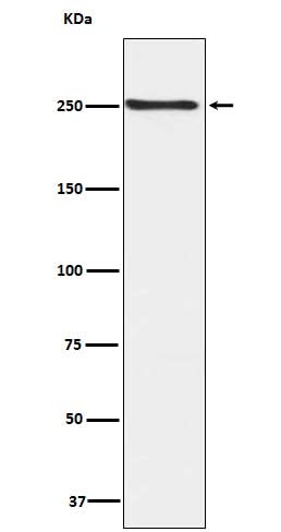Anti-Phospho-mTOR (S2448) Rabbit Monoclonal Antibody Boster Bio