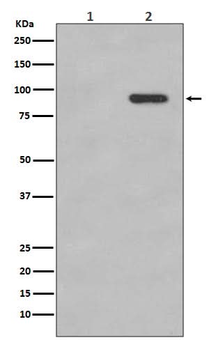 Anti-Phospho-beta Catenin (S33/S37) CTNNB1 Rabbit Monoclonal Antibody Boster Bio