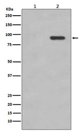 Anti-Phospho-beta Catenin (S33/S37) CTNNB1 Rabbit Monoclonal Antibody Boster Bio