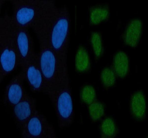 Anti-Phospho-STAT3 (S727) Rabbit Monoclonal Antibody Boster Bio