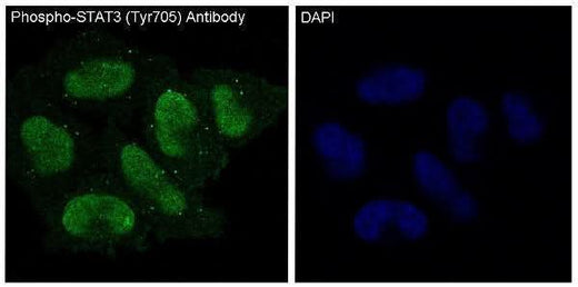 Anti-Phospho-STAT3 (Y705) Rabbit Monoclonal Antibody Boster Bio