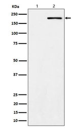 Anti-Phospho-ErbB2 (Y1139) Rabbit Monoclonal Antibody Boster Bio