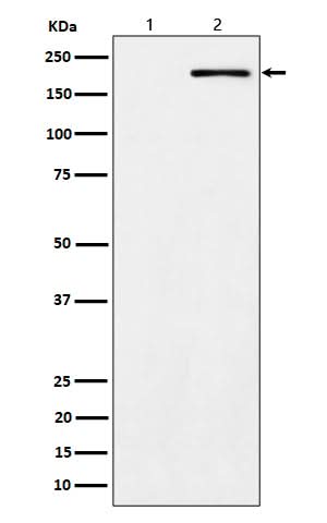 Anti-Phospho-ErbB2 (Y1139) Rabbit Monoclonal Antibody Boster Bio