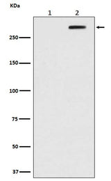 Anti-Phospho-ATM (S1981) Rabbit Monoclonal Antibody Boster Bio