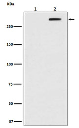 Anti-Phospho-ATM (S1981) Rabbit Monoclonal Antibody Boster Bio