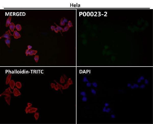 Anti-Phospho-EGFR (Y1197) Rabbit Monoclonal Antibody Boster Bio