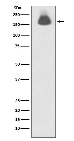 Anti-Phospho-EGFR (S695) Rabbit Monoclonal Antibody Boster Bio
