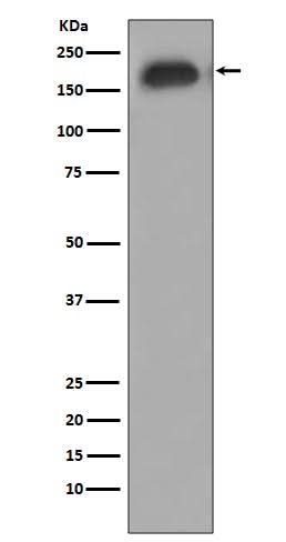 Anti-Phospho-EGFR (Y1092) Rabbit Monoclonal Antibody Boster Bio