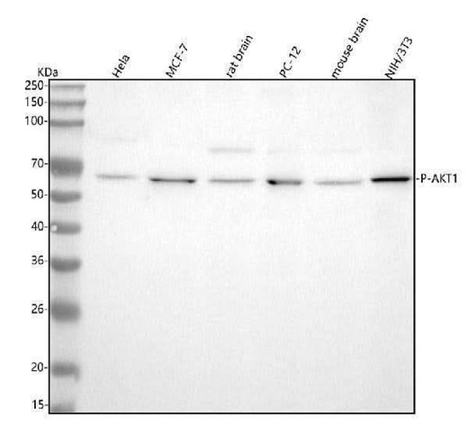 Anti-Phospho-AKT1 (T450) Rabbit Monoclonal Antibody Boster Bio