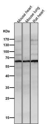 Anti-Phospho-AKT1 (S129) Rabbit Monoclonal Antibody Boster Bio
